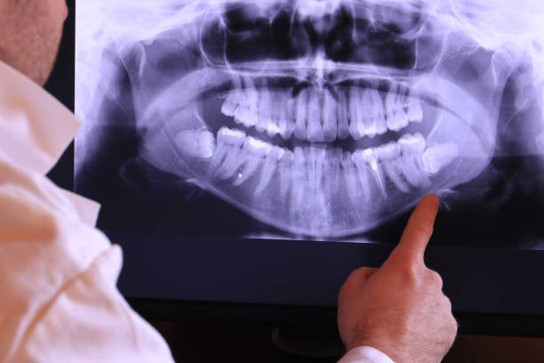Best Dentist for Tooth Abscess  in Occoquan, VA