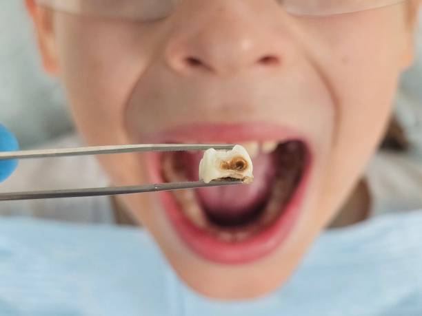 Best Dentist for Dental Trauma  in Occoquan, VA